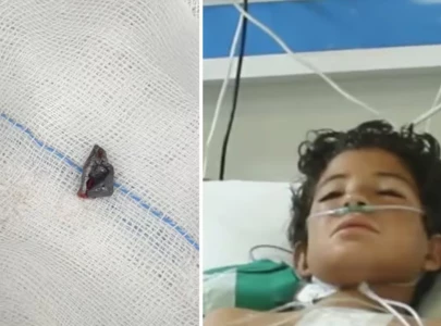 bullet removed from 12 year old s heart at nicvd