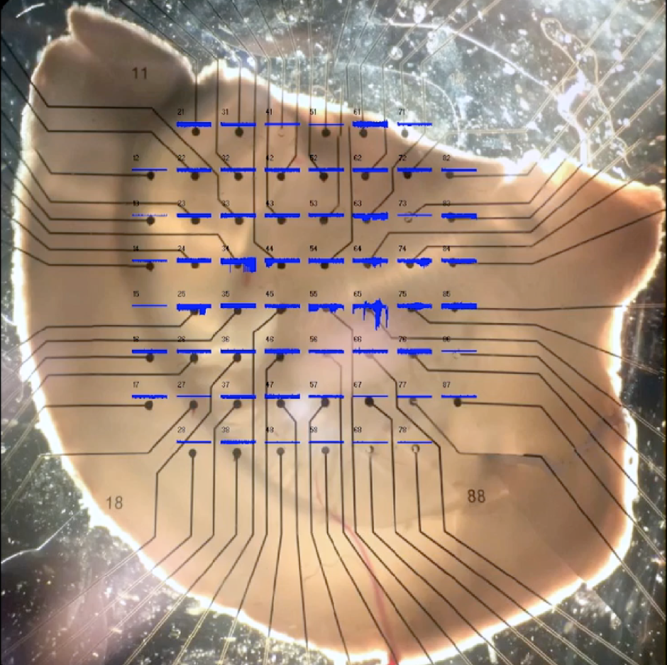 This image shows a slice of human brain cell on a chip. PHOTO: FILE