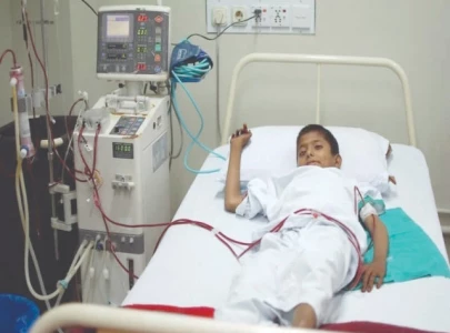 less than 30 of children with cancer survive in pakistan experts less than 30 of children with cancer survive in pakistan experts