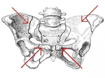 women need plenty of sunlight milk to protect bones experts