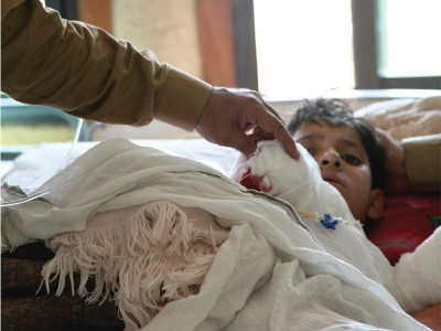 stop drop and roll and other first aid tips if you get burnt