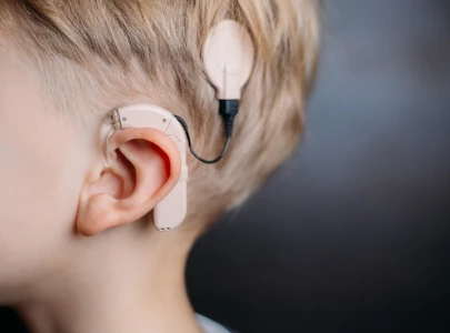 peshawar launches cochlear implant programme for hearing impaired children peshawar launches cochlear implant programme for hearing impaired children