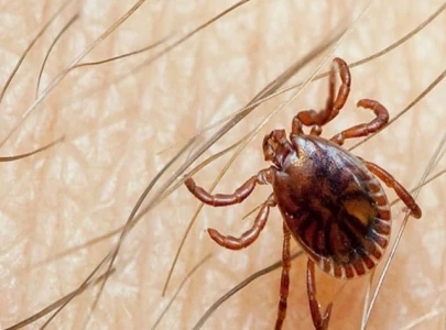 first congo virus case of the year reported in karachi first congo virus case of the year reported in karachi