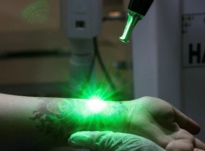 indonesians flock to free tattoo removal service to atone during ramadan indonesians flock to free tattoo removal service to atone during ramadan