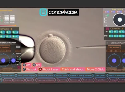 world s first baby born via ai powered ivf system world s first baby born via ai powered ivf system