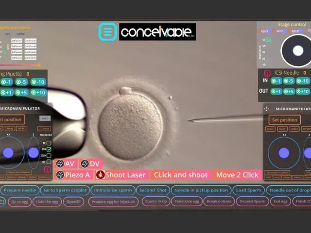 what a medical professional sees when they supervise the ivf procedure via a livestream photo conceivable life sciences what a medical professional sees when they supervise the ivf procedure via a livestream photo conceivable life sciences