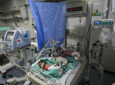 infant 4 year old child die of hunger in gaza infant 4 year old child die of hunger in gaza