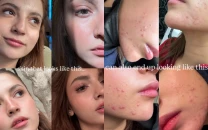 can we all just be kinder dananeer mobeen opens up about acne struggle in honest instagram post