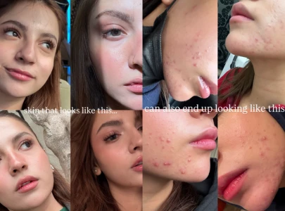 can we all just be kinder dananeer mobeen opens up about acne struggle in honest instagram post