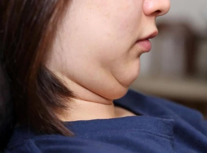 want to get rid of double chin here s what you can do want to get rid of double chin here s what you can do