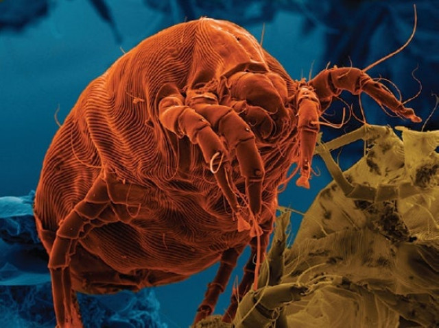 four allergist approved ways to get rid of dust mites four allergist approved ways to get rid of dust mites