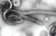 this is an electron microscopic image of an isolate of ebola virus photo cdc public health image library this is an electron microscopic image of an isolate of ebola virus photo cdc public health image library