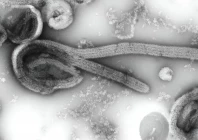 this is an electron microscopic image of an isolate of ebola virus photo cdc public health image library this is an electron microscopic image of an isolate of ebola virus photo cdc public health image library