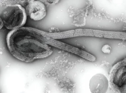 who says suspected ebola cases drop to 116 after hundreds ruled out