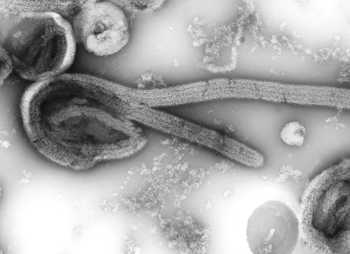 This is an electron microscopic image of an isolate of Ebola virus. PHOTO: CDC Public Health Image Library