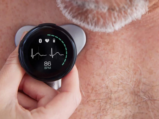 the ai stethoscope uses a card sized sensor and microphone to detect heart sounds and blood flow beyond human hearing photo eko health the ai stethoscope uses a card sized sensor and microphone to detect heart sounds and blood flow beyond human hearing photo eko health