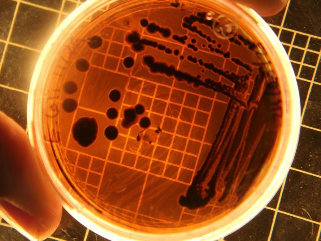 the british team of researchers behind the new study sought to find a solution to the two problems by roping in a third e coli which is normally known for making people sick when they eat contaminated food photo pixabay the british team of researchers behind the new study sought to find a solution to the two problems by roping in a third e coli which is normally known for making people sick when they eat contaminated food photo pixabay