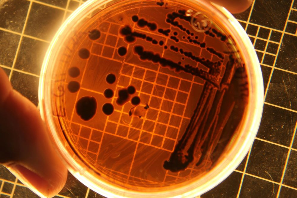 E. coli can turn plastic into painkillers, chemists discover | The Express Tribune