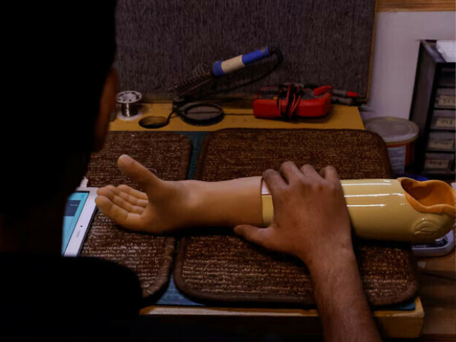 A technician checks a prosthetic limb at the Bioniks, in Karachi, April 29, 2024. — Reuters