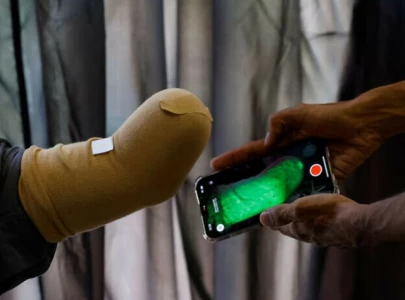 startup from karachi ships prosthetic limbs to gaza s youngest victims startup from karachi ships prosthetic limbs to gaza s youngest victims