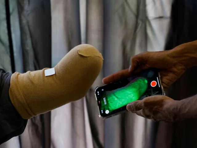 a technician uses a mobile phone for 3d scan of a patient before developing a prosthetic limb at bioniks in karachi april 29 2024 reuters a technician uses a mobile phone for 3d scan of a patient before developing a prosthetic limb at bioniks in karachi april 29 2024 reuters