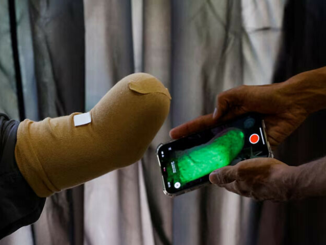 Startup from Karachi ships prosthetic limbs to Gaza’s youngest victims