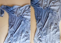 victim s clothes were burnt after the woman allegedly threw acid on him photo express