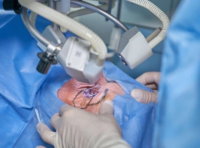 district hospitals lack cataract surgery facilities