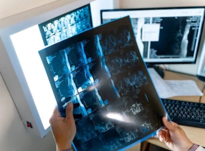 radiocontrast film shortage stalls diagnosis at govt hospitals radiocontrast film shortage stalls diagnosis at govt hospitals