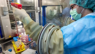 experts growing new skin for swiss fire victims photo afp