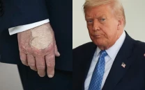 donald trump covers hand with makeup in washington dc appearance fuelling speculation over health