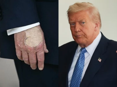 donald trump covers hand with makeup in washington dc appearance fuelling speculation over health donald trump covers hand with makeup in washington dc appearance fuelling speculation over health