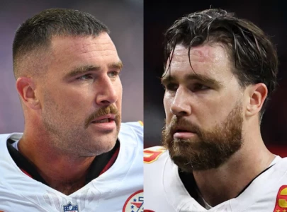 travis kelce s barber breaks silence on nfl star s hair transplant rumours
