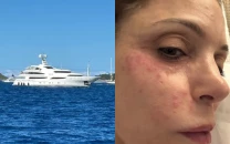 viral claim of super chlamydia in st barts circulates as bethenny frankel discusses holiday infection