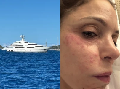 viral claim of super chlamydia in st barts circulates as bethenny frankel discusses holiday infection viral claim of super chlamydia in st barts circulates as bethenny frankel discusses holiday infection