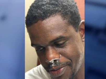 florida man arrested after attempting to hide cocaine in his nose