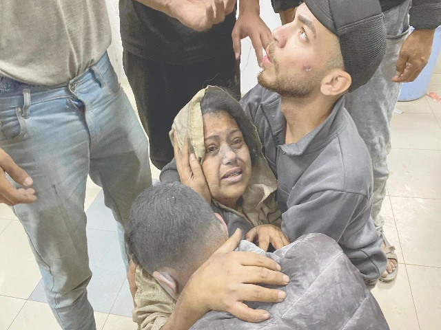 palestinians who were injured in israeli strikes on displacement tents in khan yunis react after they arrive at the nasser hospital in the southern gaza strip photo afp palestinians who were injured in israeli strikes on displacement tents in khan yunis react after they arrive at the nasser hospital in the southern gaza strip photo afp