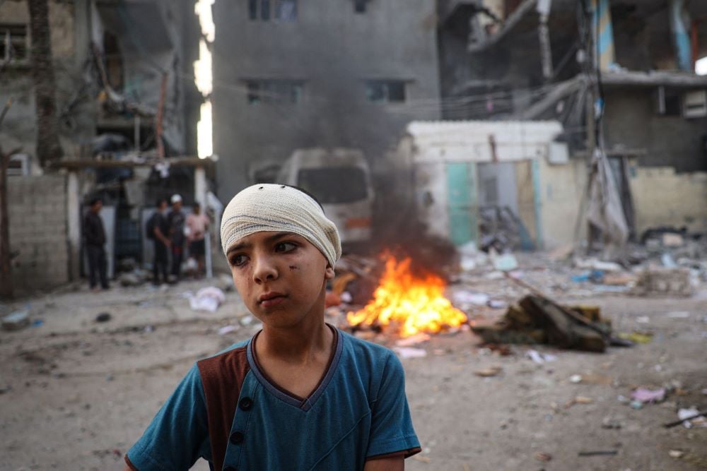 An injured Palestinian boy stands next to the rubble of a family house in Rafah, southern Gaza, Palestine, May 20, 2024. PHOTO: AFP
