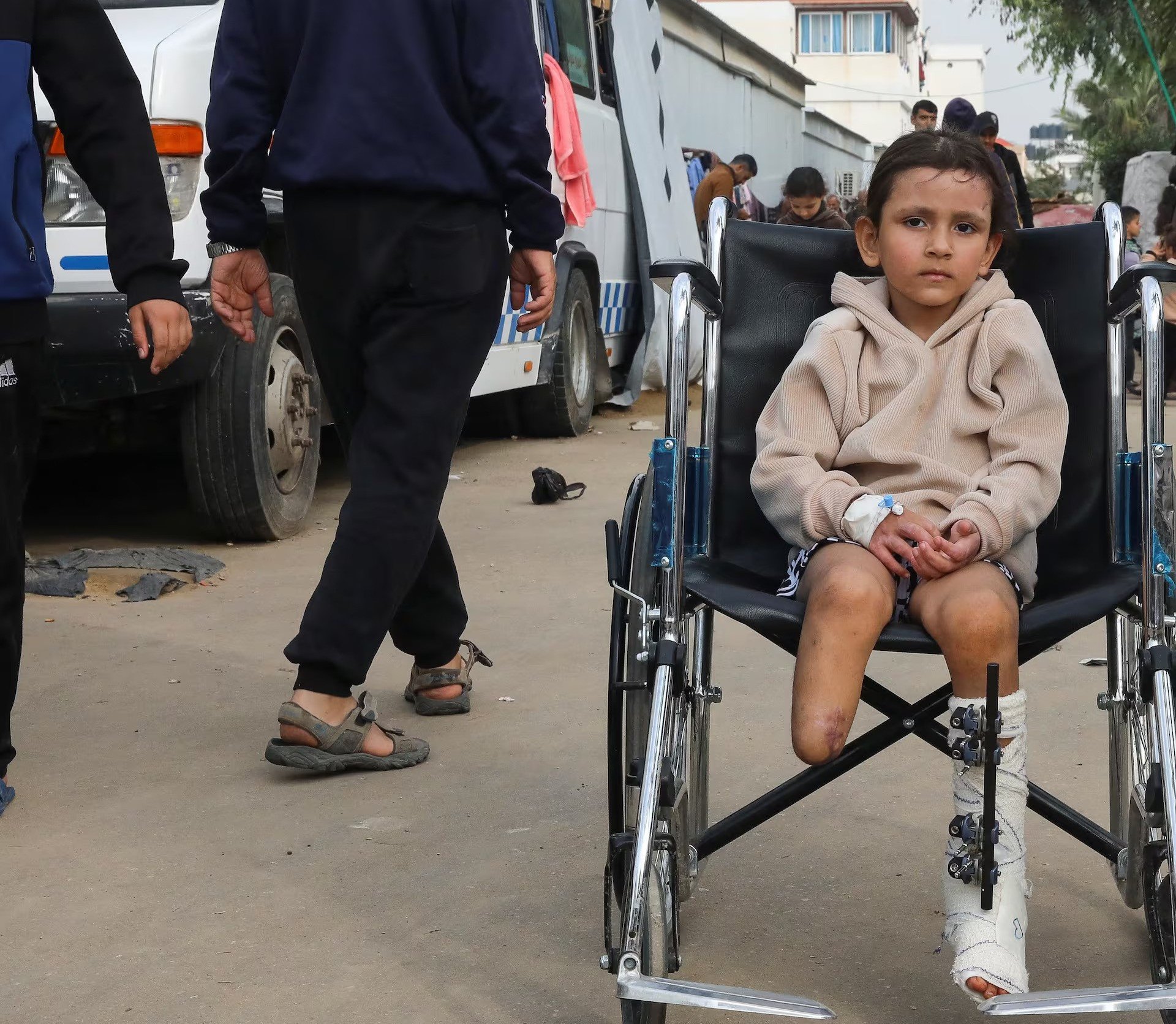 a child in gaza with amputed leg photo reuters