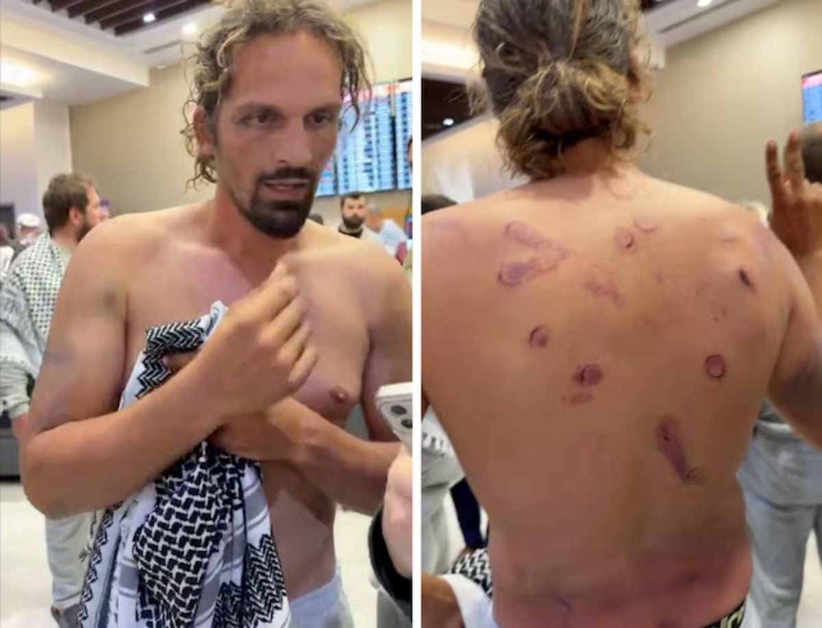 Adrien Jouan, an activist from the Gaza-bound Global Sumud Flotilla, who was detained by Israeli forces after their vessels were intercepted in international waters in the Mediterranean, gestures as he shows his bruises and injuries following his arrival at the airport in Istanbul, Turkey, May 21, 2026. Screen grab from video/Reuters