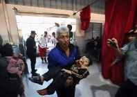 an injured child is brought to al awda hospital in central gaza after israeli bombardment on saturday photo afp