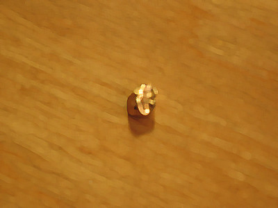 lucky woman three gold teeth make one dream house