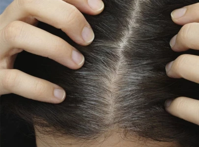 worried about grey hair here are 6 tips to slow down the process worried about grey hair here are 6 tips to slow down the process