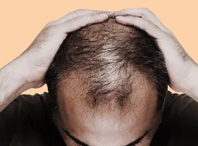 worried about hair loss here s what you can do worried about hair loss here s what you can do