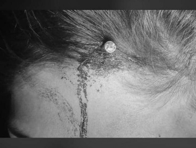 woman whose head was hammered with nail by fake peer identified woman whose head was hammered with nail by fake peer identified
