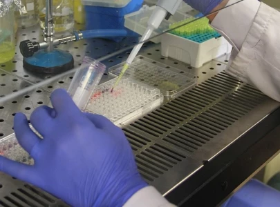 scientists find gene protecting brain from herpes virus scientists find gene protecting brain from herpes virus