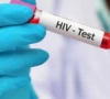 a lab assistant holds test tube filled with hiv positive blood sample photo app file