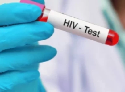 total hiv cases at karachi s kbv hospital rise to 80 as preteen toddler test positive