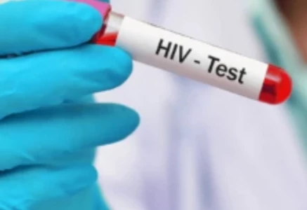 a lab assistant holds test tube filled with hiv positive blood sample photo app file