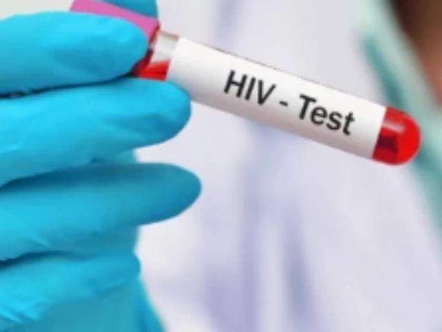 a lab assistant holds test tube filled with hiv positive blood sample photo app file a lab assistant holds test tube filled with hiv positive blood sample photo app file